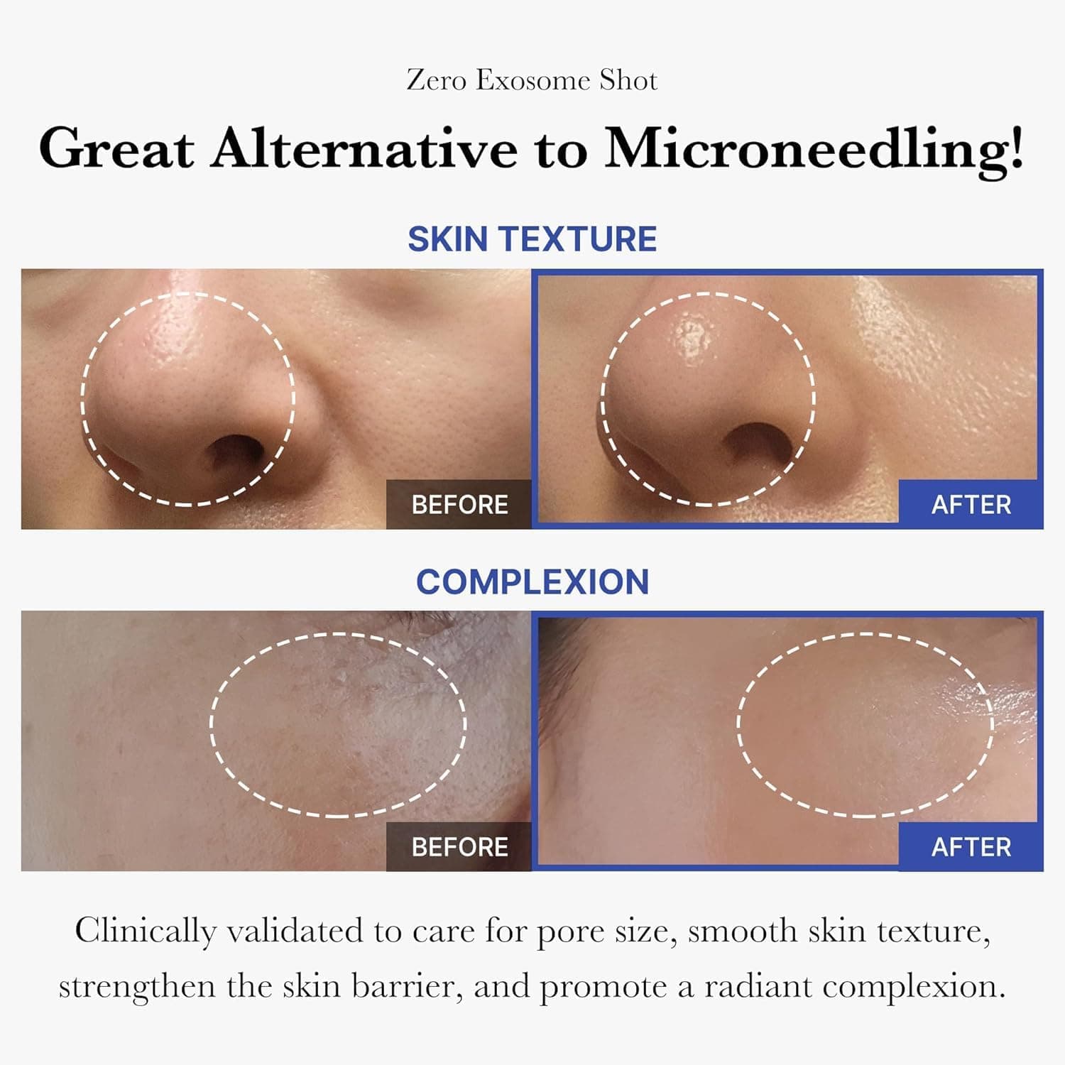 medicube Exosome Shot Zero 2000 PPM Spicule Facial Serum with Advanced Skin Absorption Technology and Powerful Exosome Delivery for Smoother Skin — 3 of 5