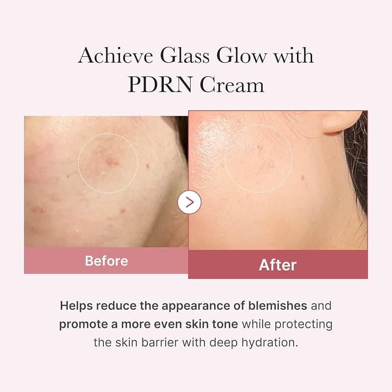 medicube Salmon DNA PDRN Pink Hyaluronic Moisturizing Cream with Hydrating Formula, Skin Barrier Support and Deep Nourishing Benefits for All Day Use — 3 of 5