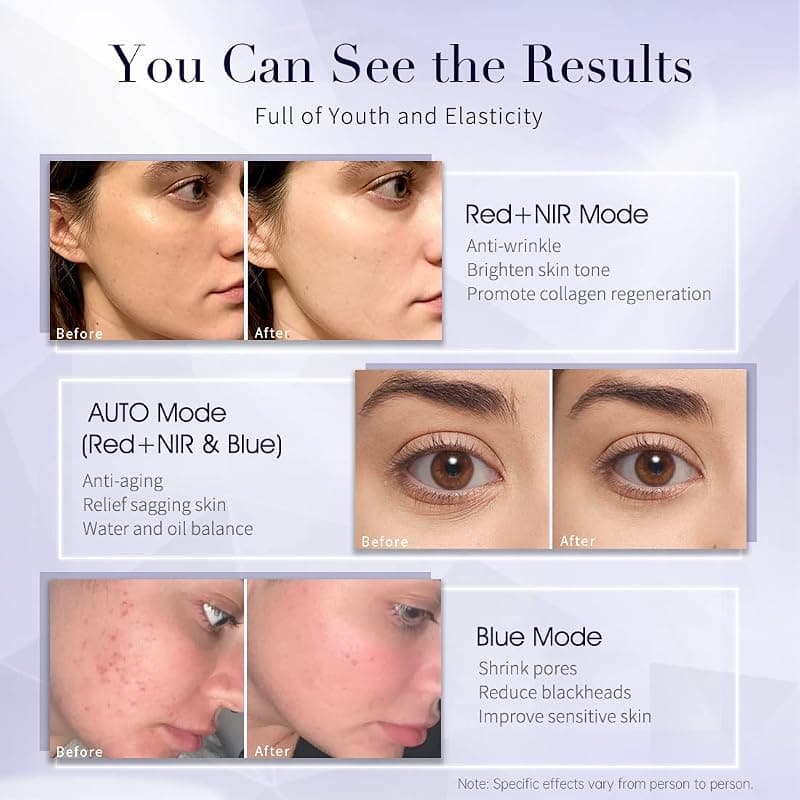 HIME SAMA LED Face Mask Red Light Therapy Miracle STAR FSA and HSA Eligible Skincare Device with Advanced Rejuvenating Technology — 4 of 5